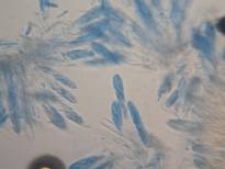 White pine from Sangerville, Maine with Canavirgella fruiting bodies and ascospores. Photos: USDA Forest Service, Northeastern Area, State and Private Forestry, Durham, NH.