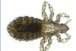 head louse magnified