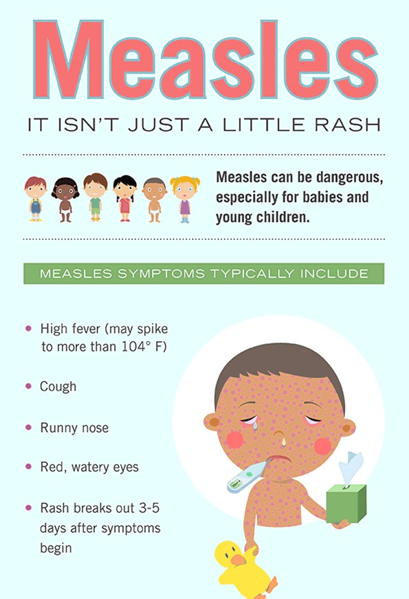 measles infographic