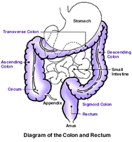 What is colon cancer? 