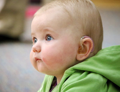 Baby wearing hearing aids.