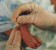 Heal prick from baby's foot