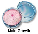 mold on the walls