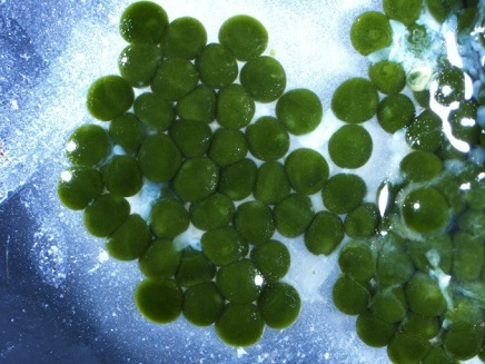 Developing lobster eggs, photographed under a microscope