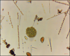 A photograph of a variety of phytoplankton species submitted by a volunteer from a sample collected at Fort Popham, Phippsburg on 10/17/22